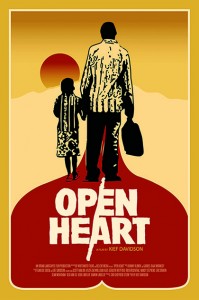 open heart